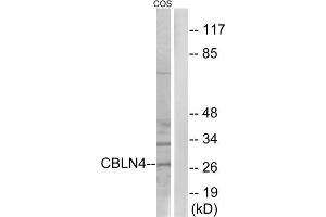 Western blot analysis of extracts from COS cells, using CBLN4 antibody. (CBLN4 抗体  (C-Term))