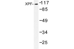 Image no. 1 for anti-Excision Repair Cross-Complementing Rodent Repair Deficiency, Complementation Group 4 (ERCC4) antibody (ABIN272306) (ERCC4 抗体)