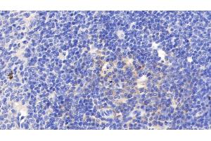 Detection of VCAM1 in Rat Spleen Tissue using Polyclonal Antibody to Vascular Cell Adhesion Molecule 1 (VCAM1) (VCAM1 抗体  (AA 369-658))