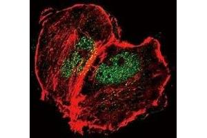 Confocal immunofluorescent analysis of phospho-Tuberin antibody with MCF-7 cells followed by Alexa Fluor 488-conjugated goat anti-rabbit lgG (green). (Tuberin 抗体  (pSer664))