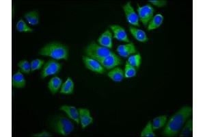 Immunofluorescence staining of Hela cells with ABIN7169831 at 1:166, counter-stained with DAPI. (SCIMP 抗体  (AA 59-145))