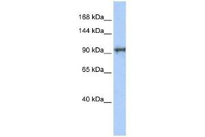 CCDC52 antibody used at 1 ug/ml to detect target protein. (SPICE1 抗体  (N-Term))