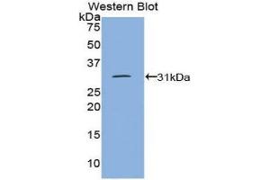 Western Blotting (WB) image for anti-Protein tyrosine Phosphatase, Receptor Type, J (PTPRJ) (AA 1061-1293) antibody (ABIN3206459) (PTPRJ 抗体  (AA 1061-1293))