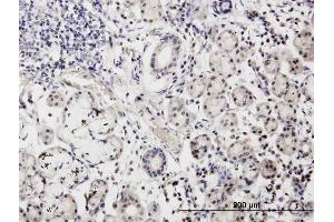 Immunostaining (ISt) image for anti-Calmodulin Like Protein 3 (CALML3) (AA 1-149) antibody (ABIN513962)