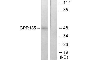Western blot analysis of extracts from NIH-3T3 cells, using GPR135 antibody. (GPR135 抗体  (Internal Region))
