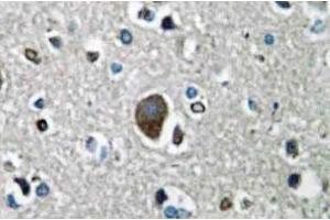 Immunohistochemistry analysis of AKAP149 Antibody in paraffin-embedded human brain tissue. (AKAP1 抗体)