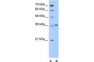 WB Suggested Anti-ALDOC Antibody Titration:  0.