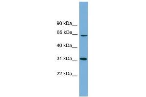 WB Suggested Anti-HSD17B11 Antibody Titration: 0.
