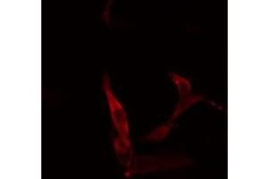 Immunofluorescence (fixed cells) (IF/ICC) image for anti-Collagen, Type II, alpha 1 (COL2A1) (N-Term) antibody (ABIN6260939)