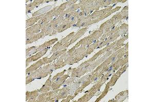 Immunohistochemistry of paraffin-embedded rat heart using SMN2 antibody. (SMN1 抗体)