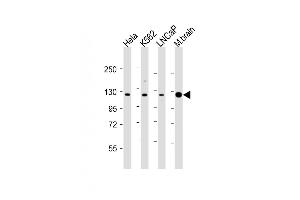 All lanes : Anti-JMJD2C Antibody (C-term) at 1:2000 dilution Lane 1: Hela whole cell lysates Lane 2: K562 whole cell lysates Lane 3: LNCaP whole cell lysates Lane 4: mouse brain lysates Lysates/proteins at 20 μg per lane.