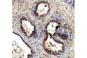 IHC analysis of ALDH1A3 using anti-ALDH1A3 antibody (ABIN5518802).