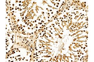 ABIN7094385 and ABIN7098432 at 1/100 staining Rat testis tissue by IHC-P. (NDOR1 抗体  (N-Term))