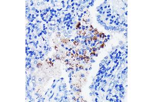 Immunohistochemistry (IHC) image for anti-Bruton Agammaglobulinemia tyrosine Kinase (BTK) antibody (ABIN7265950)