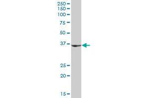 SHOX MaxPab polyclonal antibody. (SHOX 抗体  (AA 1-225))