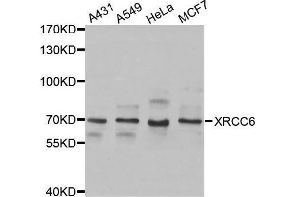 XRCC6 抗体  (AA 500-600)