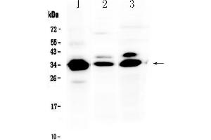 Western blot analysis of IL-1 beta using anti-IL-1 beta antibody . (IL-1 beta 抗体  (AA 117-269))