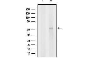 Western blot analysis of lysates from 3, using alpha 2 Glycine Receptor Antibody.
