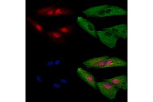 ABIN6259182 and ABIN6273697 staining  cells by IF/ICC. (SAP130 抗体  (C-Term))