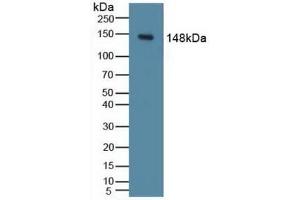 Detection of PIK3Cd in Mouse Liver Tissue using Polyclonal Antibody to Phosphoinositide-3-Kinase Catalytic Delta Polypeptide (PIK3Cd) (PIK3CD 抗体  (AA 774-1044))