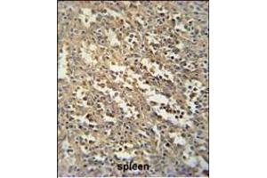 Immunohistochemistry (Paraffin-embedded Sections) (IHC (p)) image for anti-SWIM-Type Zinc Finger 7 Associated Protein 1 (SWSAP1) (AA 84-110) antibody (ABIN651737)