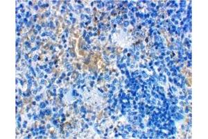 Immunohistochemistry (IHC) image for anti-Lymphocyte Antigen 96 (LY96) (Middle Region) antibody (ABIN1030999)