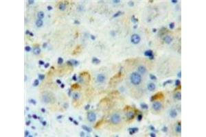 Used in DAB staining on fromalin fixed paraffin-embedded Liver tissue (PVRL2 抗体  (AA 83-291))