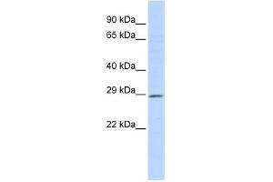 WB Suggested Anti-PSMG1 Antibody Titration:  0. (PSMG1 抗体  (Middle Region))