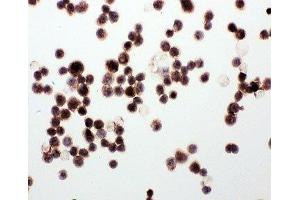 ICC testing of WISP1 antibody and MCF-7 cells (WISP1 抗体  (C-Term))