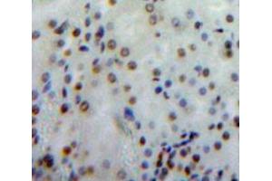 Used in DAB staining on fromalin fixed paraffin-embedded Kidney tissue (Merlin 抗体  (AA 30-239))