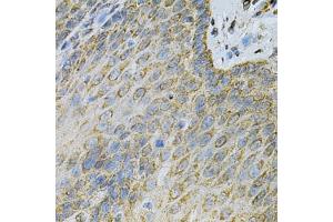 Immunohistochemistry of paraffin-embedded human esophagus using  Antibody (ABIN6127328, ABIN6136696, ABIN6136697 and ABIN6217467) at dilution of 1:100 (40x lens). (Adenylate Kinase 1 抗体  (AA 1-194))