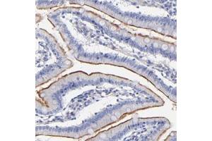Immunohistochemical staining of human small intestine with SLC44A2 polyclonal antibody  shows membranous positivity in glandular cells. (SLC44A2 抗体)