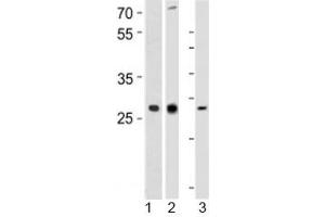 Western blot analysis of 1) human CEM, 2) rat PC-12, and 3) mouse spleen tissue lysate using LIF antibody at 1:1000. (LIF 抗体  (AA 72-101))