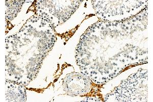ABIN6258168 and ABIN6273861 at 1/100 staining Rat testis tissue by IHC-P. (GPR21 抗体  (Internal Region))