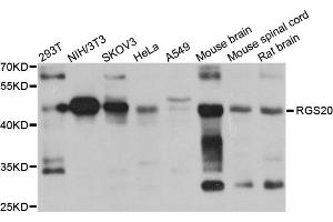 Western blot analysis of extract of various cells, using RGS20 antibody. (RGS20 抗体)