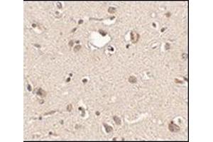Immunohistochemistry of Slitrk3 in human brain tissue with this product at 2. (SLITRK3 抗体  (C-Term))