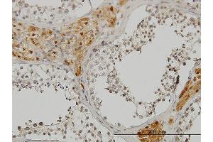 Immunostaining (ISt) image for anti-CAMP Responsive Element Binding Protein 3 (CREB3) (AA 273-371) antibody (ABIN564569)