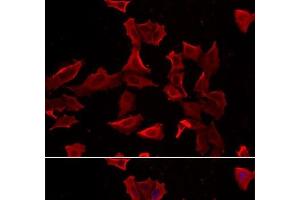 Immunofluorescence analysis of HeLa cells using ADSS Polyclonal Antibody (ADSS 抗体)