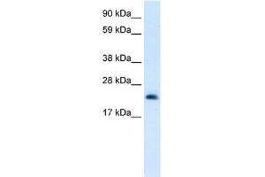 WB Suggested Anti-HMGB3 Antibody Titration:  0. (HMGB3 抗体  (C-Term))
