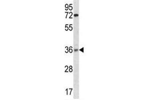 XRCC2 antibody western blot analysis in ZR-75-1 lysate (XRCC2 抗体  (AA 1-30))