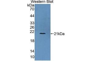 Western Blotting (WB) image for anti-Collagen, Type VI, alpha 3 (COL6a3) (AA 463-624) antibody (ABIN1867320) (COL6a3 抗体  (AA 463-624))