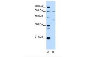 Image no. 2 for anti-Replication Factor C (Activator 1) 5, 36.5kDa (RFC5) (N-Term) antibody (ABIN6738219) (RFC5 抗体  (N-Term))