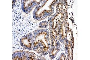 Immunohistochemistry (IHC) image for anti-Hydroxysteroid (17-Beta) Dehydrogenase 4 (HSD17B4) (C-Term) antibody (ABIN3031274)