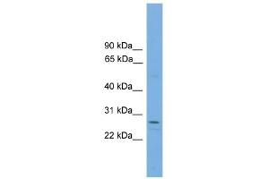 WB Suggested Anti-RCAN1 Antibody Titration: 0. (RCAN1 抗体  (N-Term))