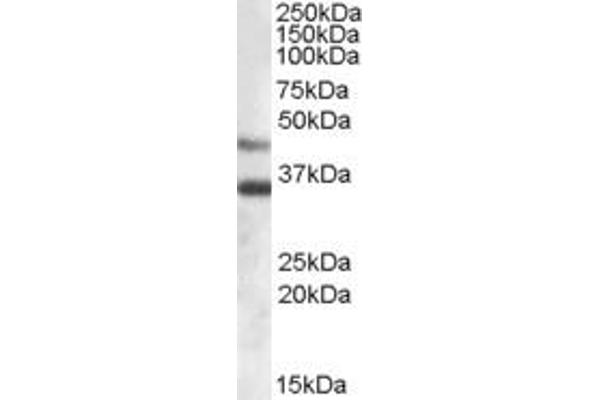 Arylsulfatase B 抗体  (Internal Region)