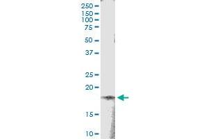 Immunoprecipitation of TSEN15 transfected lysate using anti-TSEN15 MaxPab rabbit polyclonal antibody and Protein A Magnetic Bead , and immunoblotted with TSEN15 MaxPab mouse polyclonal antibody (B01) . (TSEN15 抗体  (AA 1-171))
