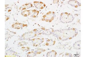 Formalin-fixed and paraffin embedded rat kidney tissue labeled with Anti-PRKD3 Polyclonal Antibody, Unconjugated (ABIN754678) at 1:200 followed by conjugation to the secondary antibody and DAB staining (PRKD3 抗体  (AA 345-550))
