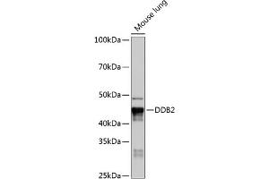 Western blot analysis of extracts of Mouse lung, using DDB2 Rabbit mAb (ABIN7266674) at 1:1000 dilution. (DDB2 抗体)