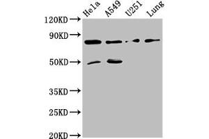 Western Blot Positive WB detected in: Hela whole cell lysate, A549 whole cell lysate, U251 whole cell lysate, Mouse lung tissue All lanes: Pcsk1 antibody at 8 μg/mL Secondary Goat polyclonal to rabbit IgG at 1/50000 dilution Predicted band size: 85 kDa Observed band size: 85 kDa (PCSK2 抗体  (AA 267-391))