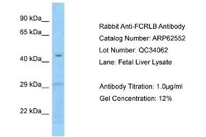Western Blotting (WB) image for anti-Fc Receptor-Like B (FCRLB) (N-Term) antibody (ABIN2789176) (FCRLB 抗体  (N-Term))
